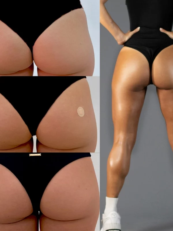 juicy-back-caso-caa-2