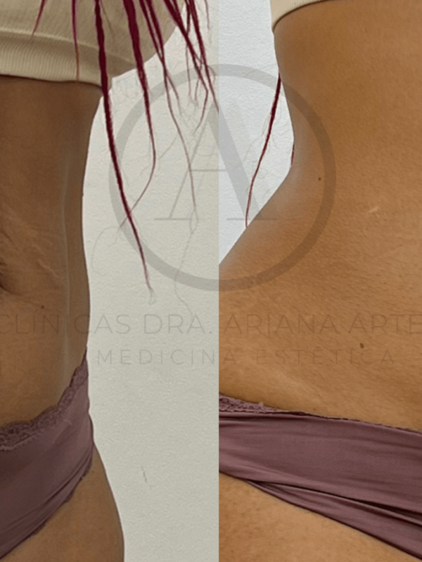 Body Shape Intense Pack en Valencia